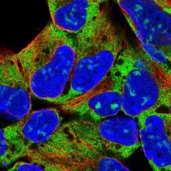 RPL18 Antibody, Novus Biologicals 0.1mL; Unlabeled:Antibodies, Polyclonal